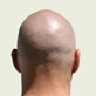 baldtyre